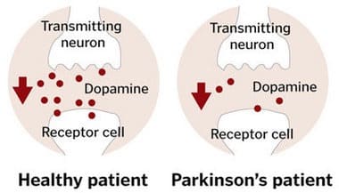 Parkinsons-dopamine