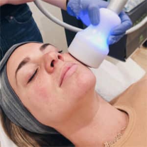 ChillSkin Anti-Aging and Tightening Treatment at ChillRx Cryotherapy Red Bank
