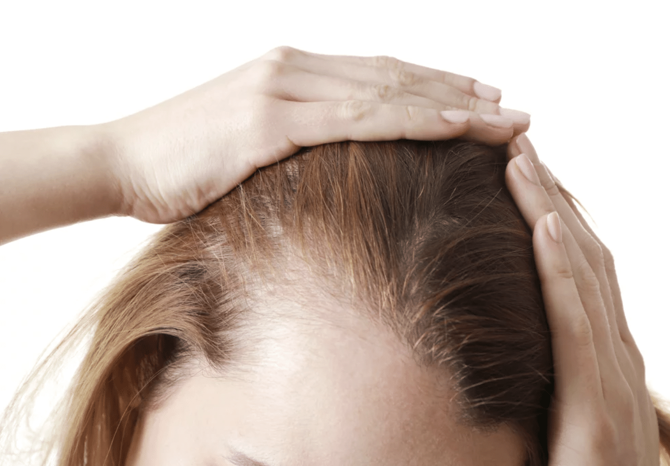Alopecia: Prevent, Treat & Reverse with Cryotherapy - Chill Cryotherapy -  Red Bank